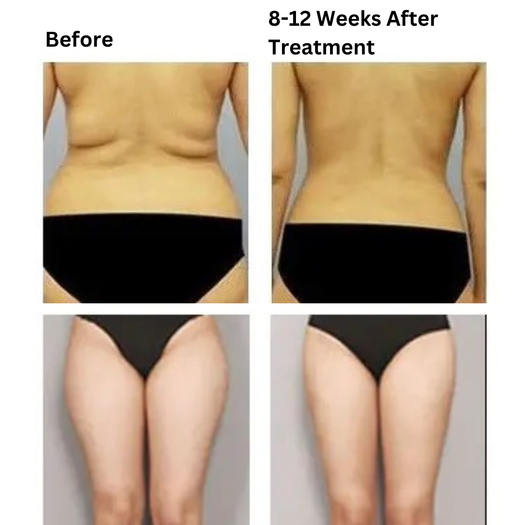 comparison after using