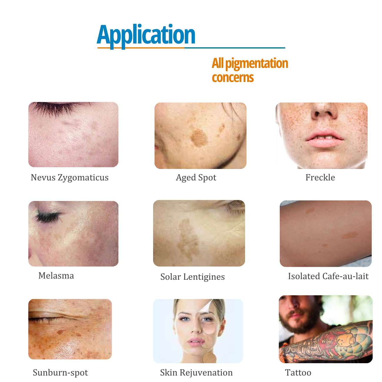 PicoPretty® Picosecond Laser Pigment Solution 750