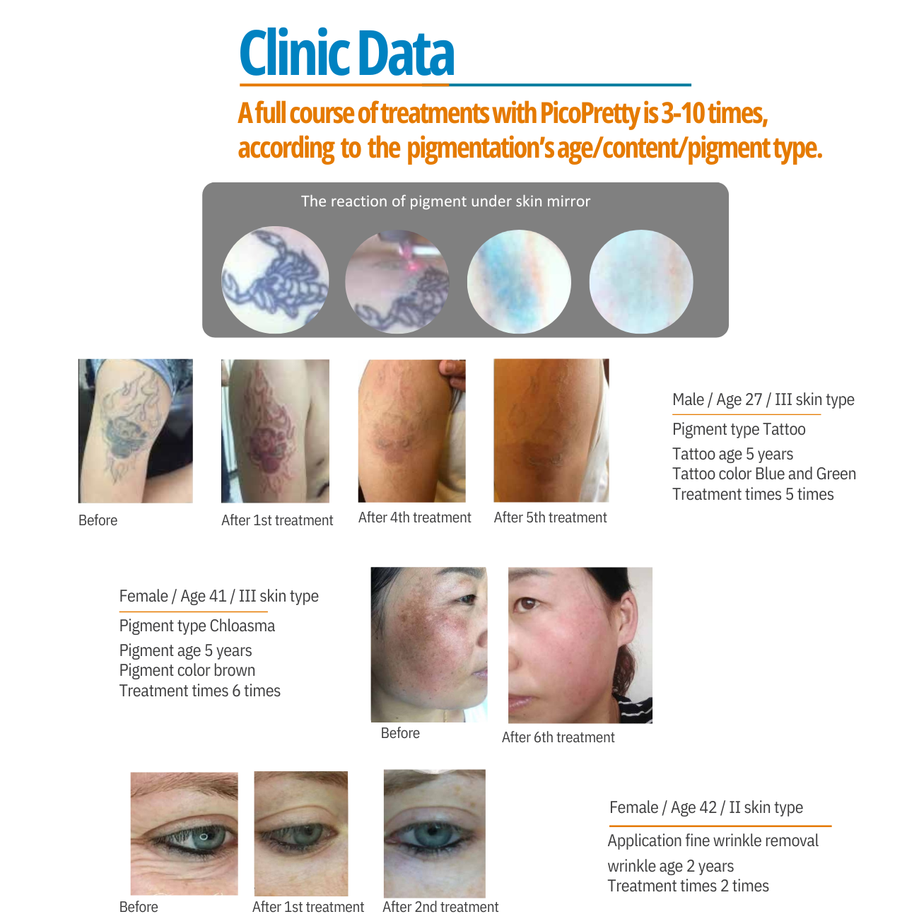 PicoPretty® Picosecond Laser Pigment Solution 750