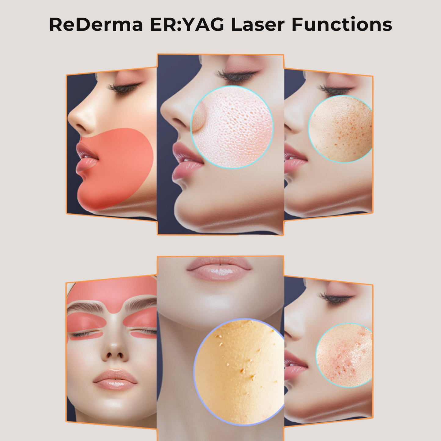 Tattoo Removal Laser Excellence Bundle B