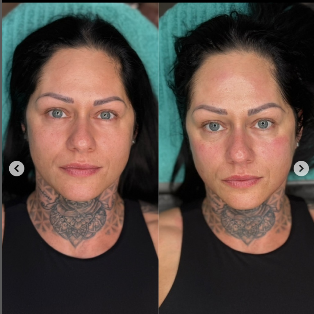 Professional PERFECT SHAPE® NEO PLUS (Body & Face)